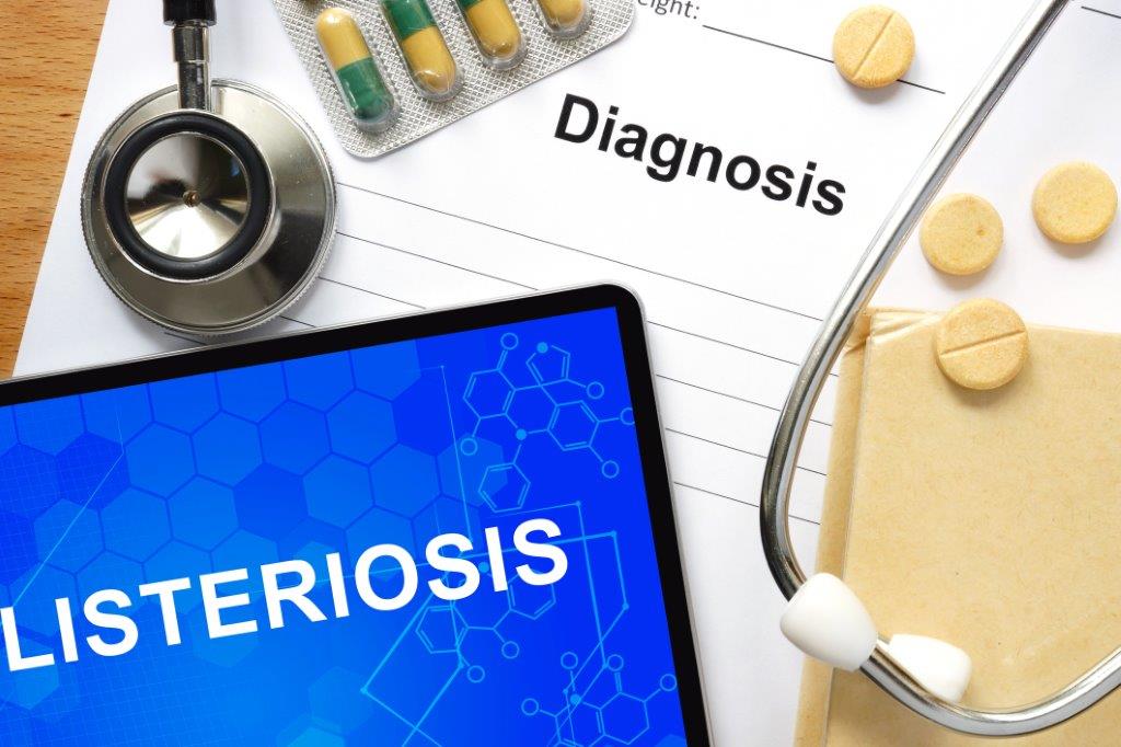 Allerta Listeria: massima attenzione al cibo