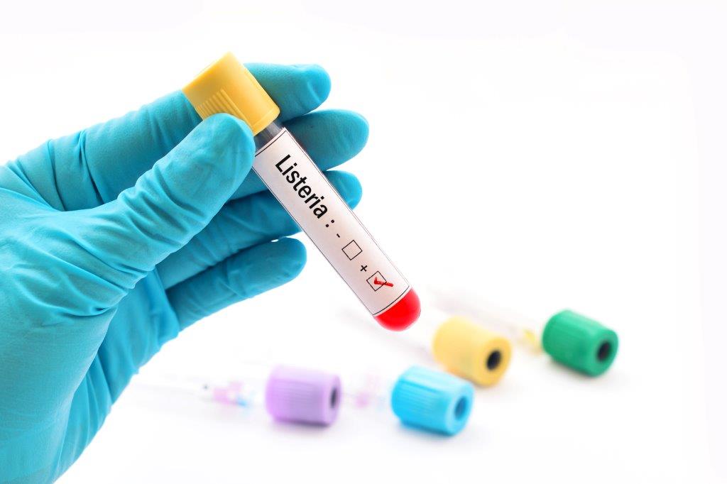 Allerta Listeria: massima attenzione al cibo